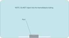 step3b-1